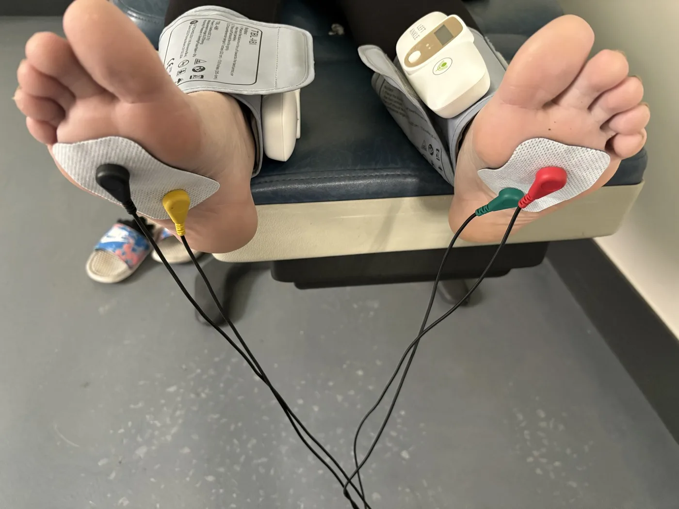 Color-coded leads running from plantar electrodes on both soles with ankle cuffs in place during combined peripheral circulation and small fiber nerve testing at Padda Institute, St. Louis