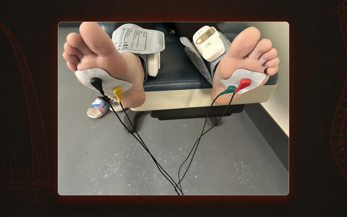 Lower-limb vascular and nerve testing with cuffs and electrodes on both feet.